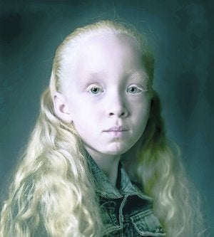 Niña albina retratada por el artista. ::
PIERRE GONNORD/